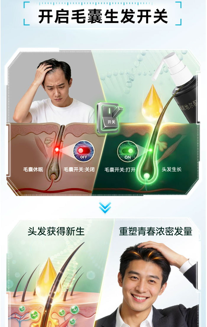 蔓迪米诺地尔男士生发液酊剂防脱密发育发